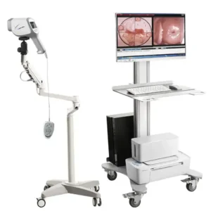 دستگاه کلپوسکوپی برای تشخیص بدخیمی دهانه رحم